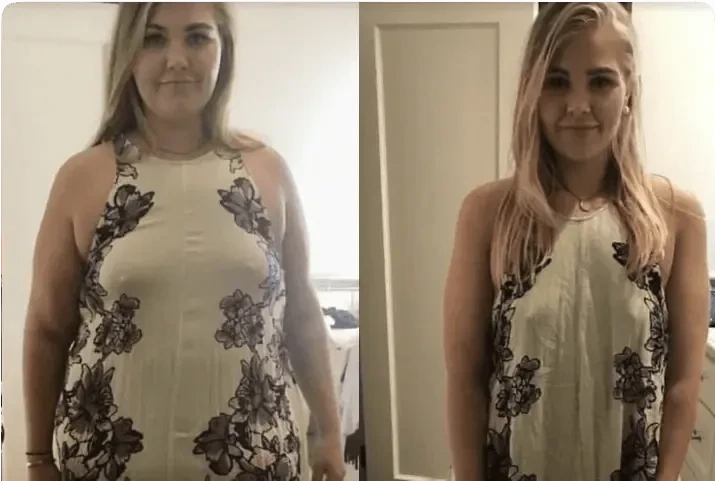 Antes e depois: emagrecimento visível na silhueta do corpo todo